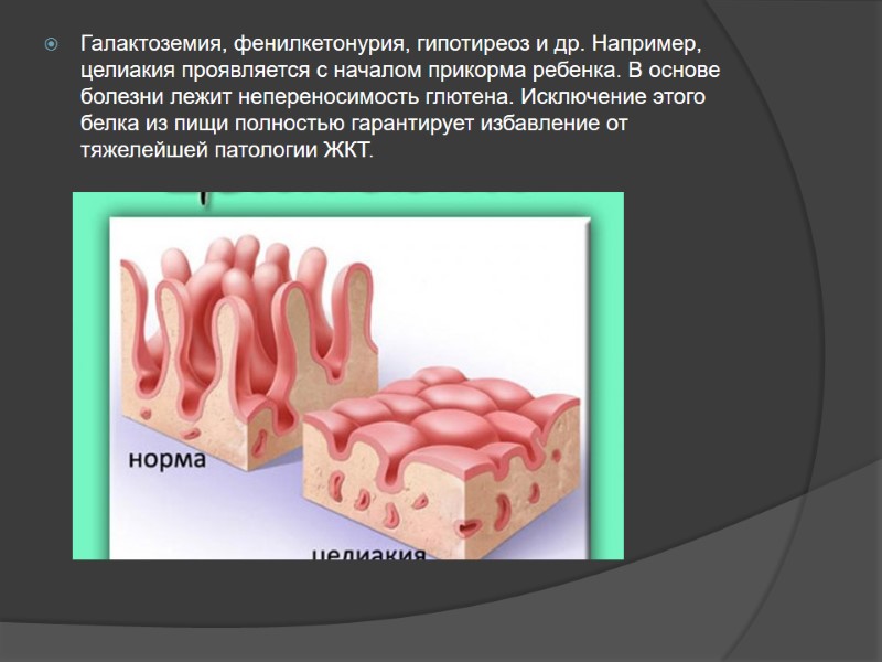 Галактоземия, фенилкетонурия, гипотиреоз и др. Например, целиакия проявляется с началом прикорма ребенка. В основе